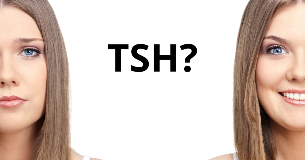 Normal TSH